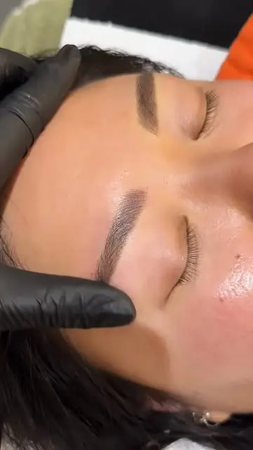 Skin treatments